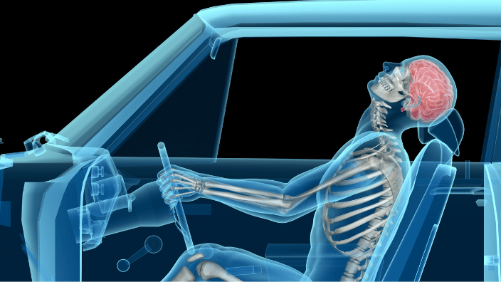 illustration of whiplash