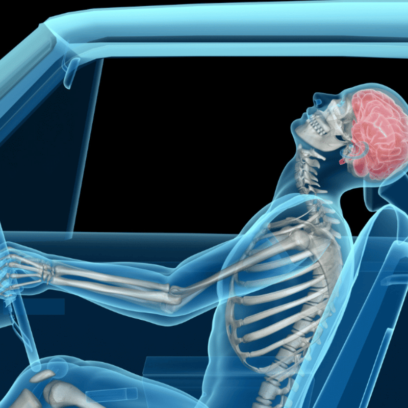 illustration of whiplash